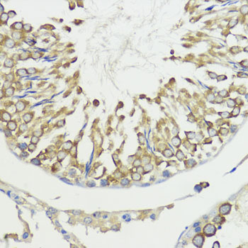 HACE1 Rabbit polyclonal antibody