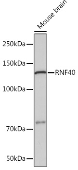 RNF40 Rabbit monoclonal antibody