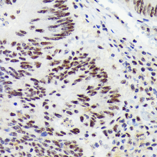 RNF40 Rabbit monoclonal antibody