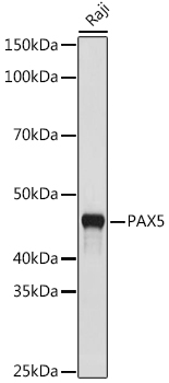 PAX5 Rabbit monoclonal antibody
