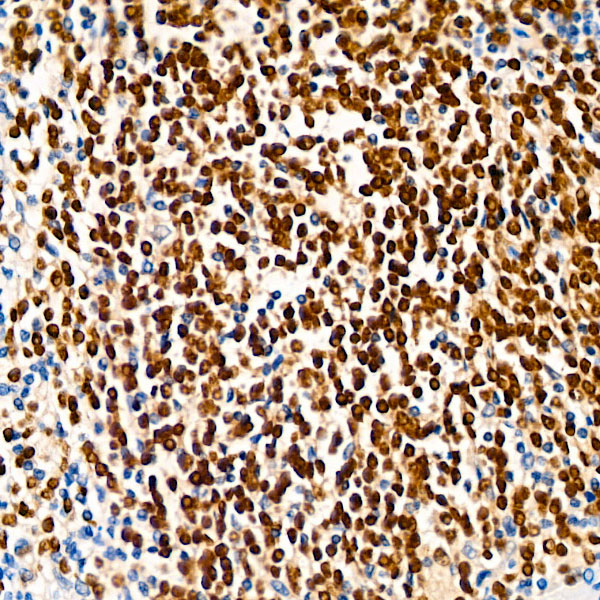 PAX5 Rabbit monoclonal antibody