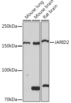 JARID2 Rabbit monoclonal antibody