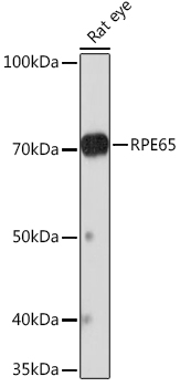 RPE65 Rabbit monoclonal antibody