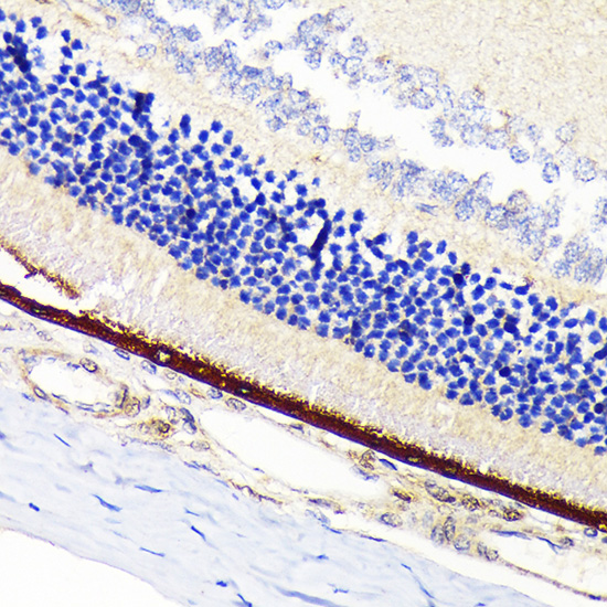 RPE65 Rabbit monoclonal antibody