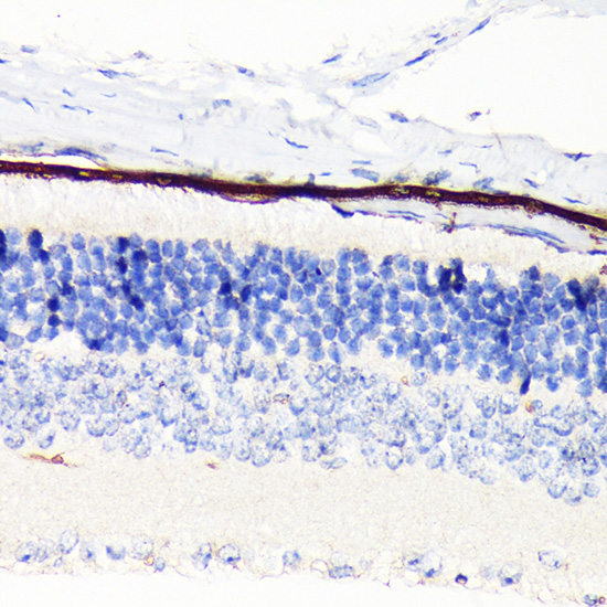 RPE65 Rabbit monoclonal antibody