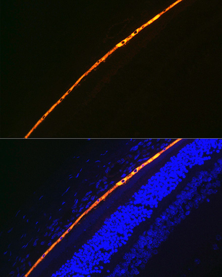 RPE65 Rabbit monoclonal antibody