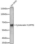 Western blot - Cytokeratin 9 (KRT9) Rabbit mAb (A9621)
