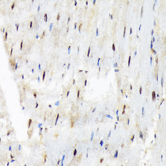 SF3B3/SAP130 Rabbit monoclonal antibody