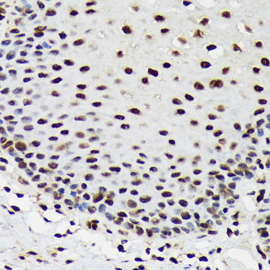 SF3B3/SAP130 Rabbit monoclonal antibody