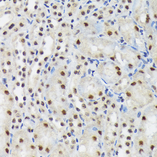 SF3B3/SAP130 Rabbit monoclonal antibody