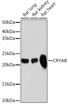 CRYAB Rabbit monoclonal antibody