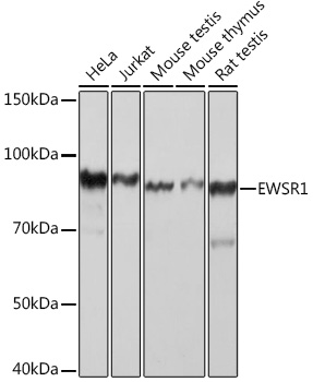 EWSR1 Rabbit monoclonal antibody