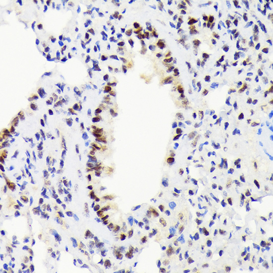 EWSR1 Rabbit monoclonal antibody