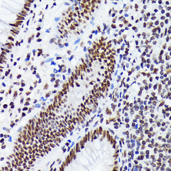 EWSR1 Rabbit monoclonal antibody