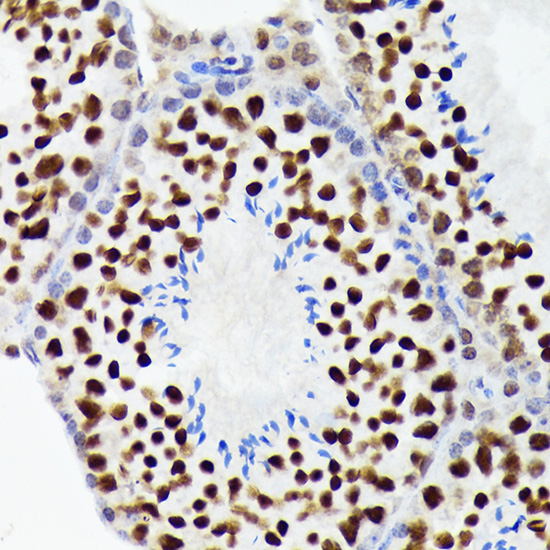 EWSR1 Rabbit monoclonal antibody