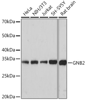 GNB2 Rabbit monoclonal antibody