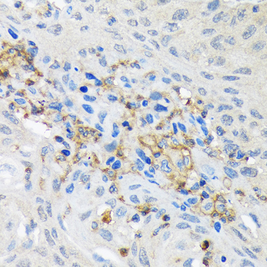 GNB2 Rabbit monoclonal antibody