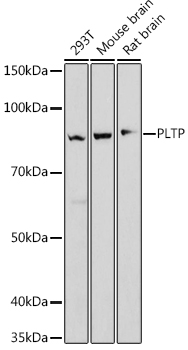 PLTP Rabbit monoclonal antibody