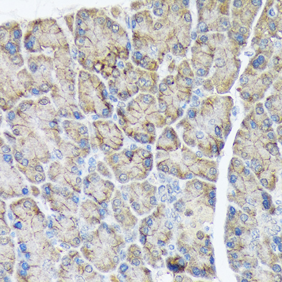 PLTP Rabbit monoclonal antibody