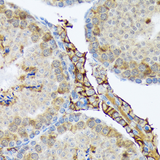 PLTP Rabbit monoclonal antibody
