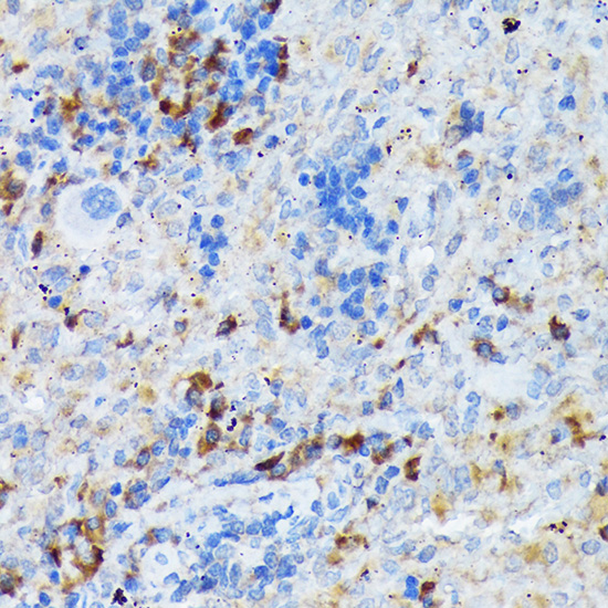 CD209 Rabbit monoclonal antibody
