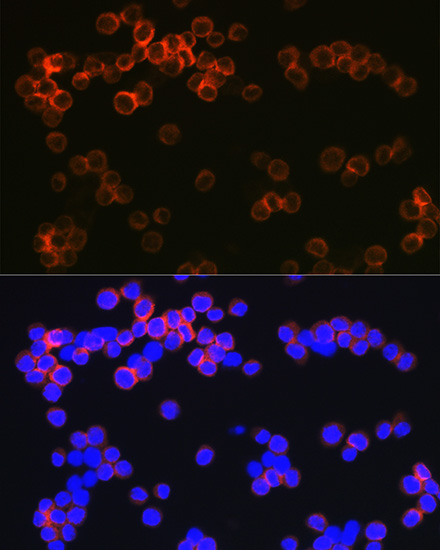CD209 Rabbit monoclonal antibody