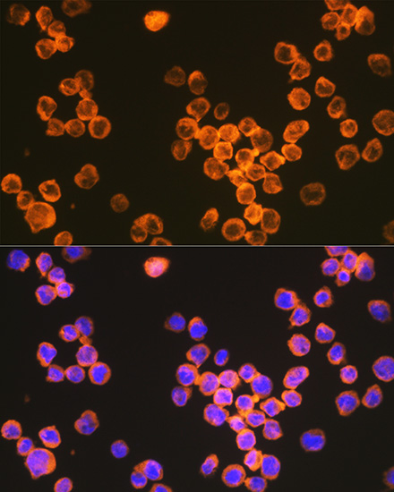 CD209 Rabbit monoclonal antibody