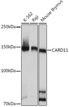 CARD11 Rabbit monoclonal antibody
