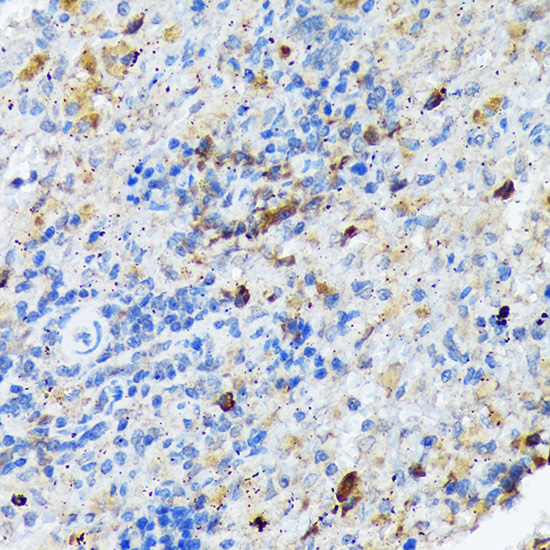 CARD11 Rabbit monoclonal antibody