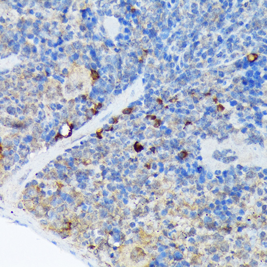 CARD11 Rabbit monoclonal antibody