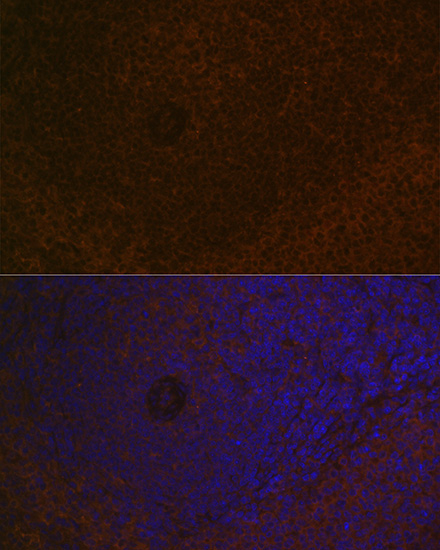 CARD11 Rabbit monoclonal antibody