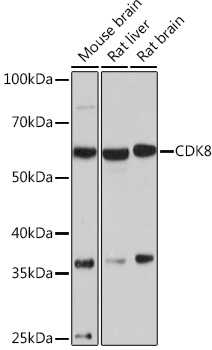 CDK8 Rabbit mAb