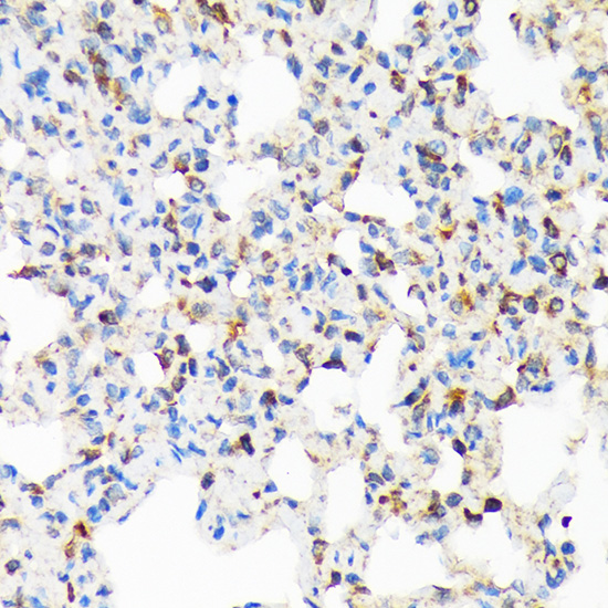 TIRAP Rabbit monoclonal antibody