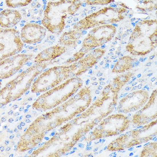 TIRAP Rabbit monoclonal antibody