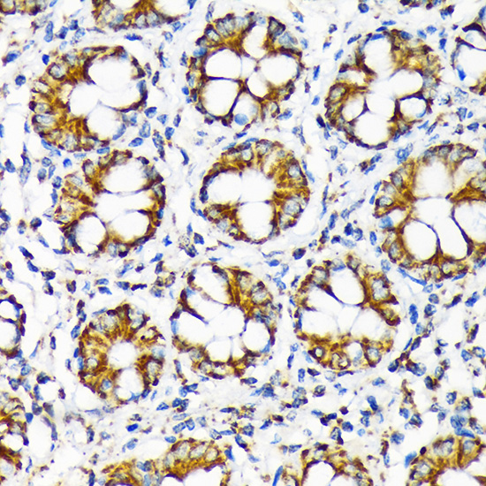 TOMM22 Rabbit monoclonal antibody