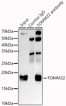 TOMM22 Rabbit monoclonal antibody