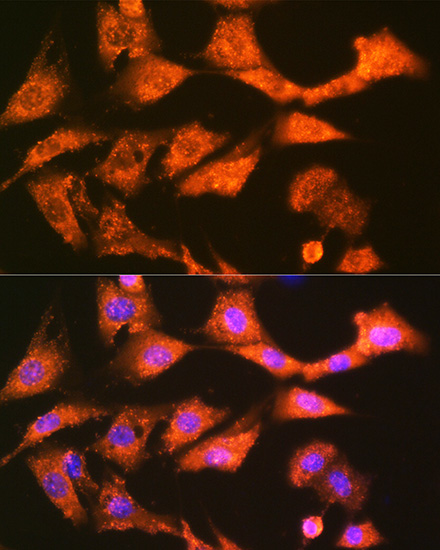 GSTK1 Rabbit monoclonal antibody