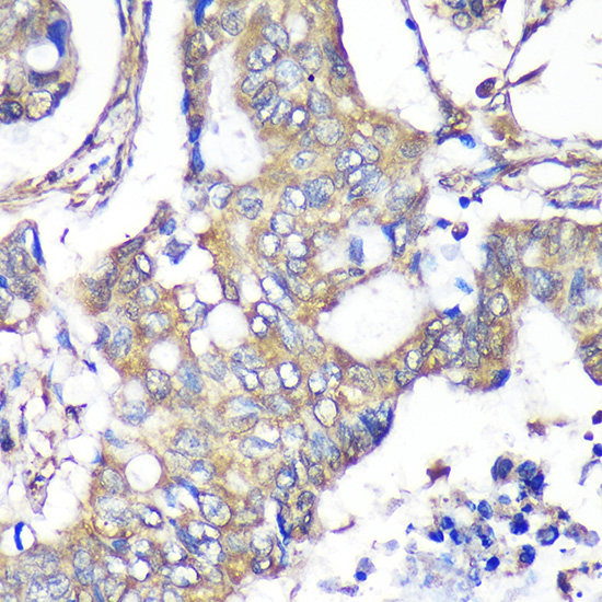 TXNDC9 Rabbit polyclonal antibody