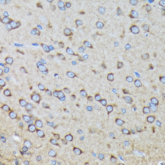 RALBP1 Rabbit monoclonal antibody