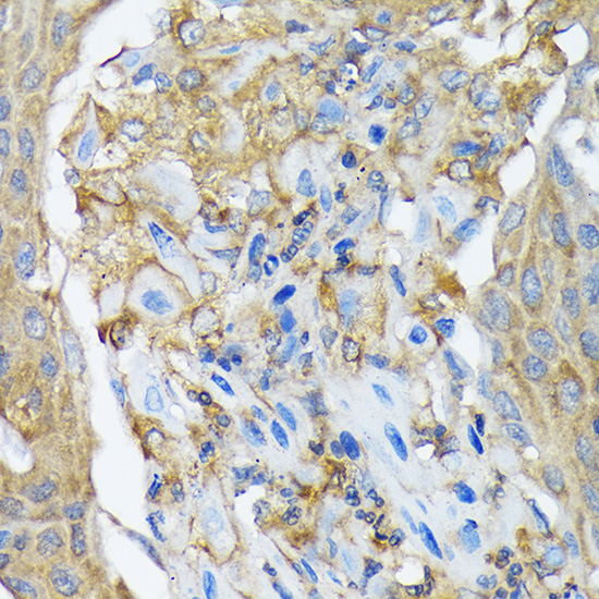 RALBP1 Rabbit monoclonal antibody