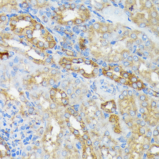 RALBP1 Rabbit monoclonal antibody