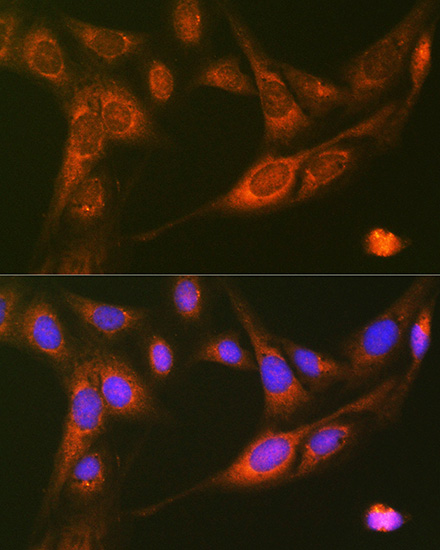 RALBP1 Rabbit monoclonal antibody