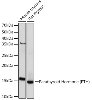 Parathyroid Hormone (PTH) Rabbit monoclonal antibody