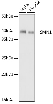 SMN1 Rabbit monoclonal antibody
