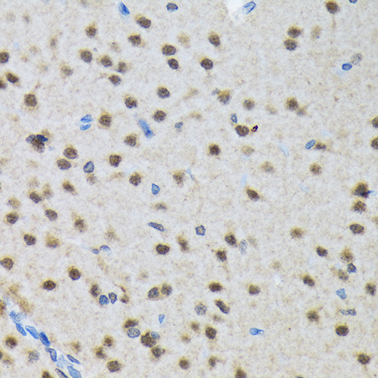 SMN1 Rabbit monoclonal antibody