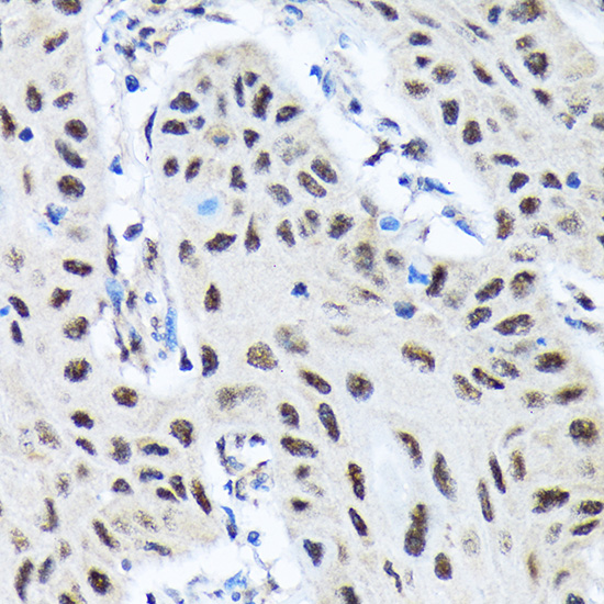 SMN1 Rabbit monoclonal antibody