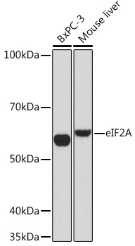 eIF2A Rabbit monoclonal antibody