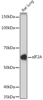 eIF2A Rabbit monoclonal antibody