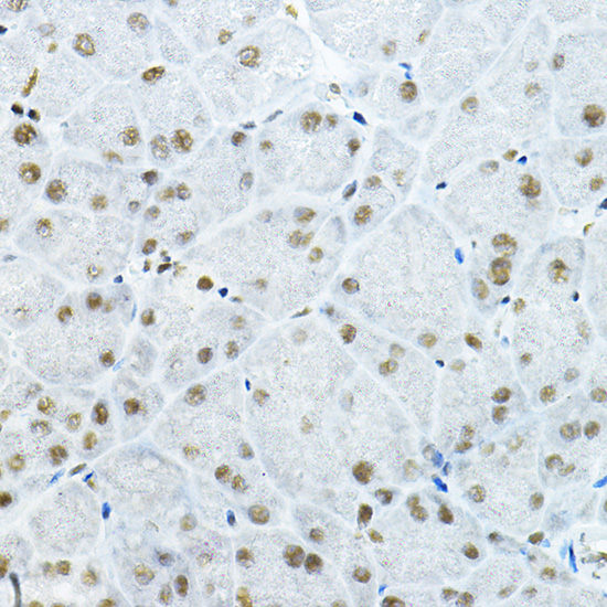 GATAD2B Rabbit polyclonal antibody