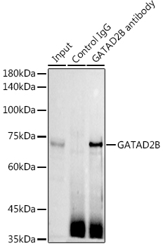 GATAD2B Rabbit polyclonal antibody